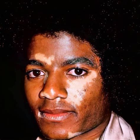 Pic Revealed Of Michael Jackson When His Skin Started Spotting