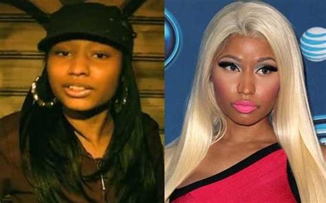 Nicki Minaj Nose Job Plastic Surgery Before And After Photos 2018