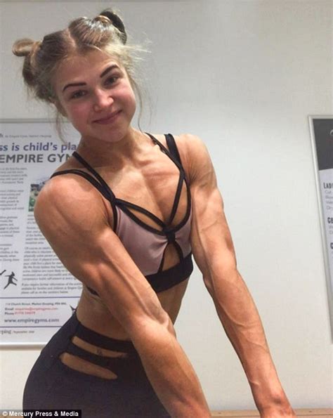 Anorexic Whose Weight Plummeted To Five Stone Turned Life Around To Become Bodybuilding Champion