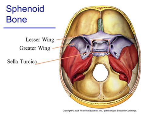 Lesser Wing Of Sphenoid Bone Hot Sex Picture