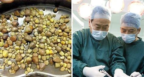 Apa kelebihan glamo health ini? Pemuda Suka Minum Tofu & Kurang Minum Air, Doktor ...