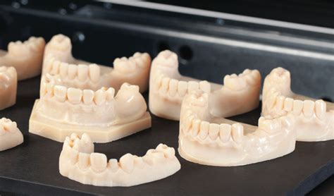 Dental 3 D Printing Technologies And Growth Wanderglobe