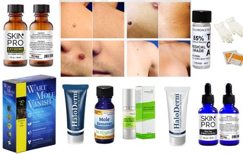 Which 10 Mole Removal Creams Are Best