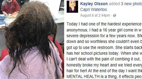 Stylist Moved By Depressed Teens Matted Hair Devotes 13 Hours To Tear