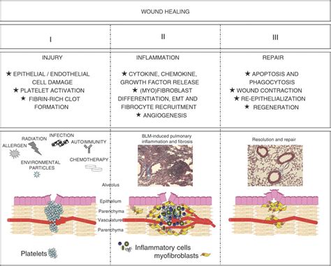 Phases Of Wound Healing A Three Phase Injury And Wound Healing Model