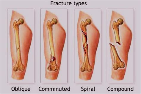 Mari kita simak inilah hasil penelitian yang dilakukan di beberapa universitas di malaysia selama 8 tahun menunjukkan bahwa teripang dapat melancarkan peredaran darah. Amalkan Doa Penawar Ini, Ikhtiar Untuk Masalah Tulang ...