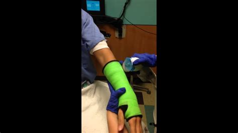 Short Arm Cast Removal Youtube