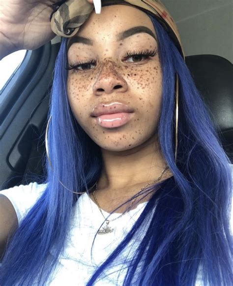 Cute Freckles Beautiful Freckles Freckles Girl Black Girls With Freckles Freckle Face Big