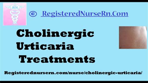 Cholinergic Urticaria Treatment Youtube