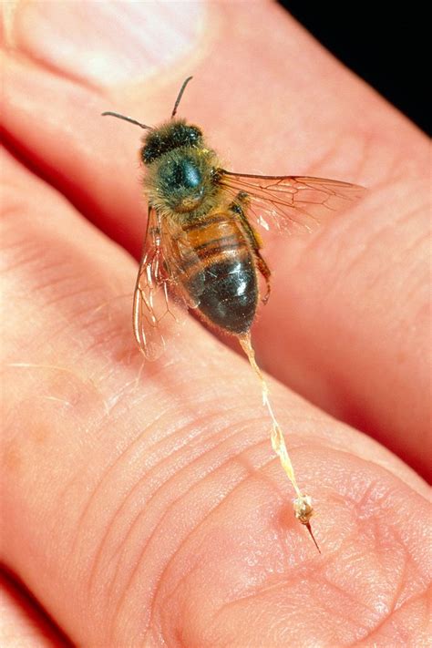 10 Tips To Avoid Getting Stung By A Bee