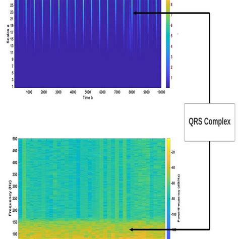 Spectrogram Vs Scalogram Download Scientific Diagram