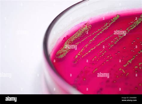 Escherichia Coli Bacteria On Blood Agar Selective Media Stock Photo Alamy