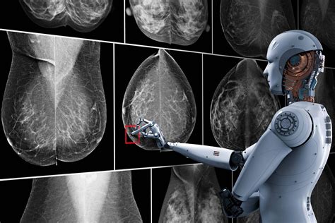 Ai Improves Breast Cancer Diagnoses Nvidia Blog