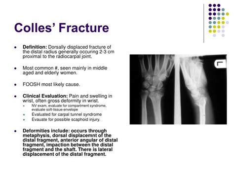 Ppt Forearm And Wrist Fractures Powerpoint Presentation Id788063