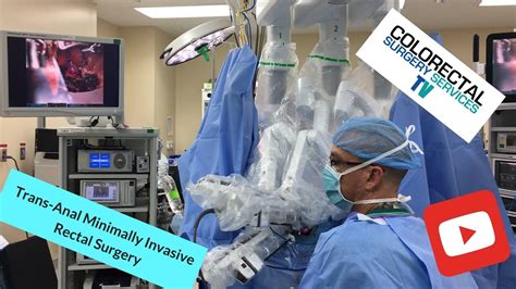 Robotic Assisted Trans Anal Minimally Invasive Surgery Less Pain Than Traditional Surgery