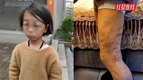云南8岁女童遭后妈虐待，因完不成作业被打肿双眼？当地多部门介入调查手机新浪网