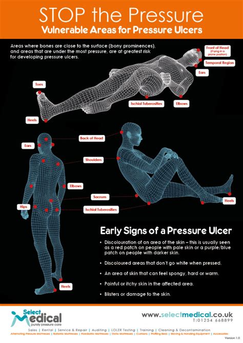 Pressure Ulcer Prevention Posters
