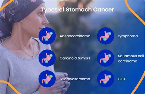 Stomach Cancer Treatment Everything You Need To Know