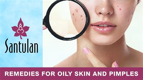 Remedies For Oily Skin And Pimples Beauty And Health Tips 03 Youtube