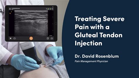 VIDEO Pain Management Case Study Treating Severe Pain With A Gluteal