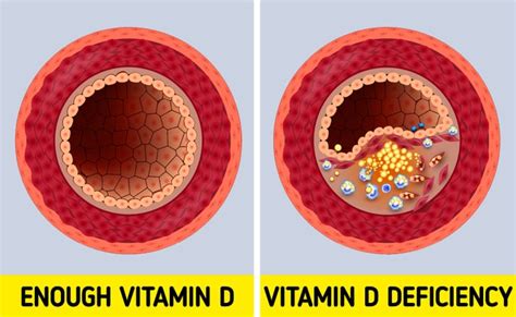 6 Warning Signs That You Are Lacking Vitamin D CreativeSide
