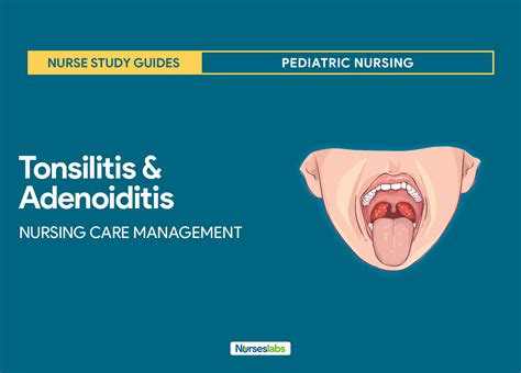 Tonsillitis And Adenoiditis Nursing Care Management Nurseslabs