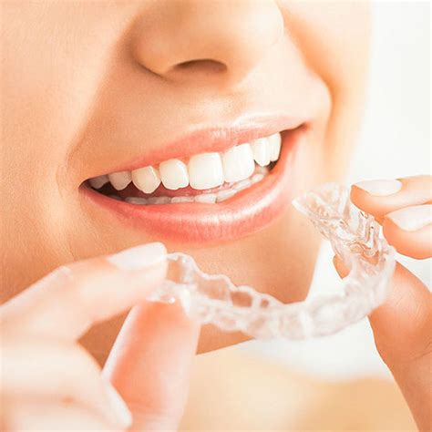The revolutionary invisalign treatment is the newest product from the align technology. Pros and Cons of Invisalign | Mint Dental