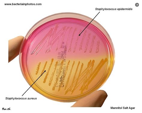 Staphylococcus Aureus And Staphylococcus Epidermidis On Mannitol Salt
