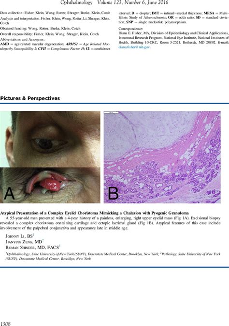Atypical Presentation Of A Complex Eyelid Choristoma Mimicking A