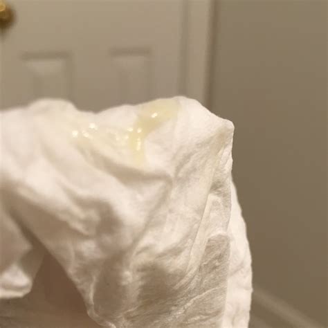 The study also reported women who smoked were more likely to have a delayed onset of pregnancy symptoms. Does this look like part of my plug or just normal ...