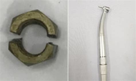 Vietnamese Man Needed To Get A Cm Steel Nut Drilled Off His Penis