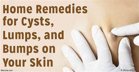 Cysts Lumps Bumps And Your Skin