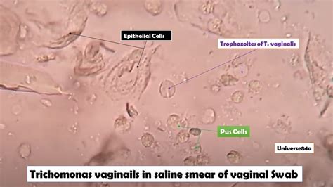 Trichomonas Vaginails Saline Smear Introduction Principle Test Require