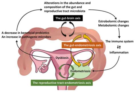 Gut And Reproductive Tract Microbiota Insights Into The Pathogenesis