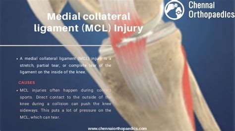 Ligament Injuries Of Knee