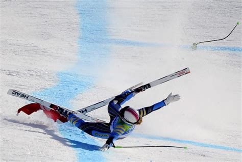 Skiunfall Wenn Die Skisaison In Gips Endet Spiegel Online