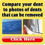 Car Dent Repair Cost