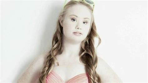 Madeline Stuart Makes History As First Model With Down Syndrome To Land