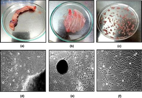 Human Umbilical Cord Dissection And Isolation Of Cells A Human