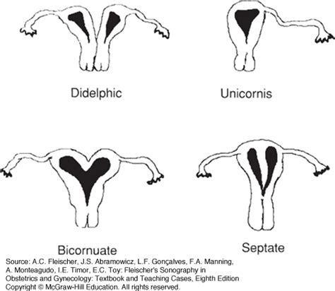 Sonographic Evaluation Of Uterine Disorders Obgyn Key