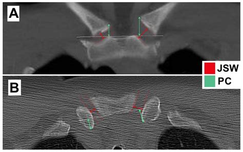 Ijerph Free Full Text Morphologic Alterations Of The