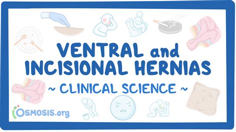 Ventral And Incisional Hernias Clinical Sciences Osmosis Video Library