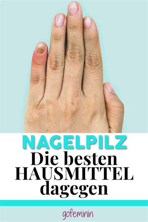 Nagelpilz Diese Hausmittel Wirken Am Besten Nagelpilz Nagelpilz