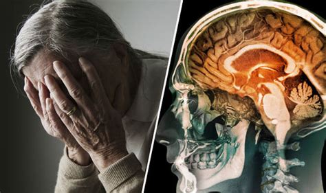 The term is used to describe a cluster of symptoms. Exclusive: What does dementia really do to the brain ...