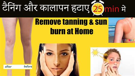 How To Remove Tan Tanning At Home Home Remedy Natural Remedy