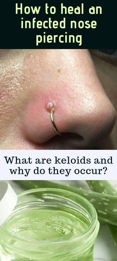 10 Natural Home Remedies For Curing Infected Keloid On Nose Piercing Nose Piercing Care Nose