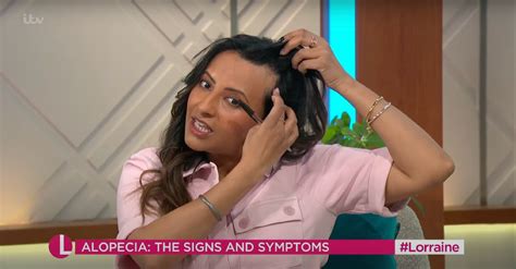 Ranvir Singh Opens Up About Alopecia Struggle On Lorraine Show