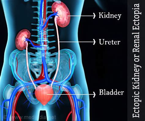 Kidney And Renal Pelvis Anatomy
