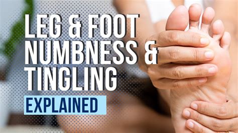 Leg And Foot Numbness And Tingling Explained Youtube