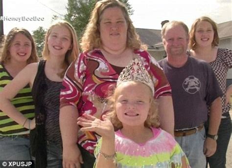 Here Comes Honey Boo Boo S Kaitlyn Cardwell Has Surgery To Have Extra Thumb Removed Daily Mail